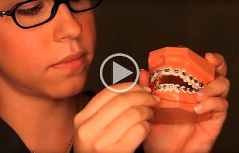 AAO Hidden Valley Orthodontics in Escondido, CA