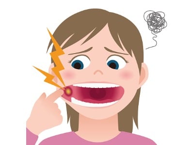 a cartoon of a girl opening her mouth to show a canker sore